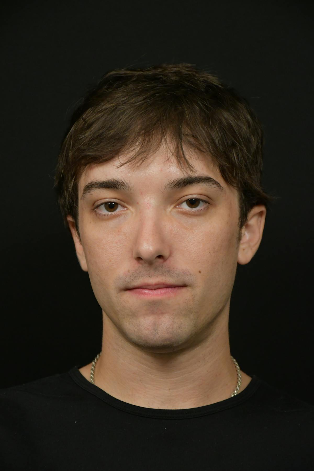 Skin Rejuvenation Before & After Gallery - Patient 314208 - Image 1