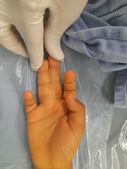 Child patients hand