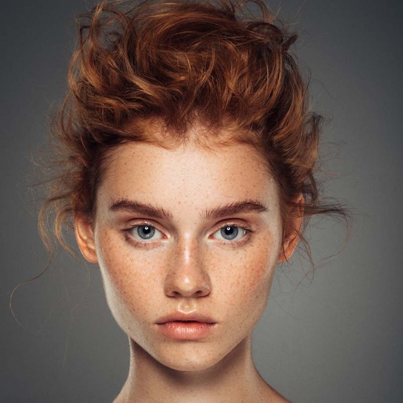 Beautiful skin after microneedling at Serotonin Centers.