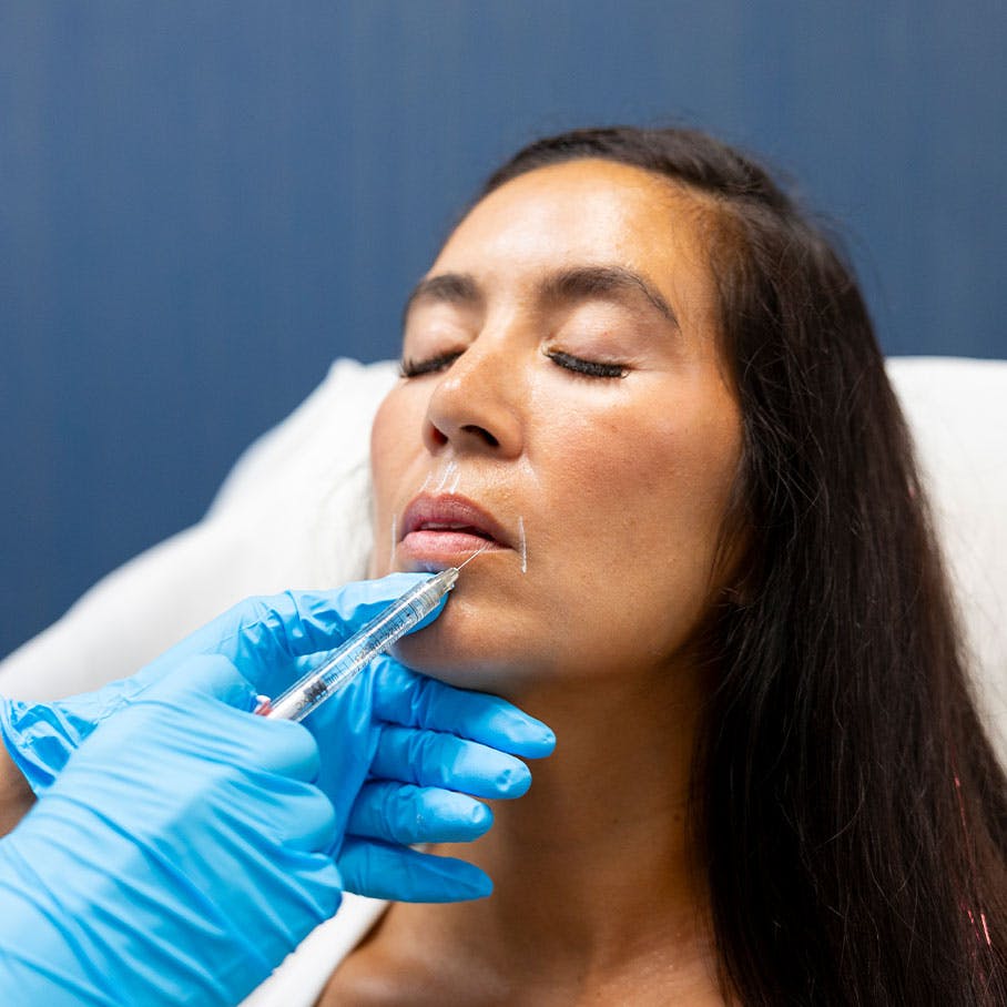 woman receiving Restylane dermal filler injection in Orlando