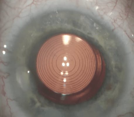 extreme close up of an eye