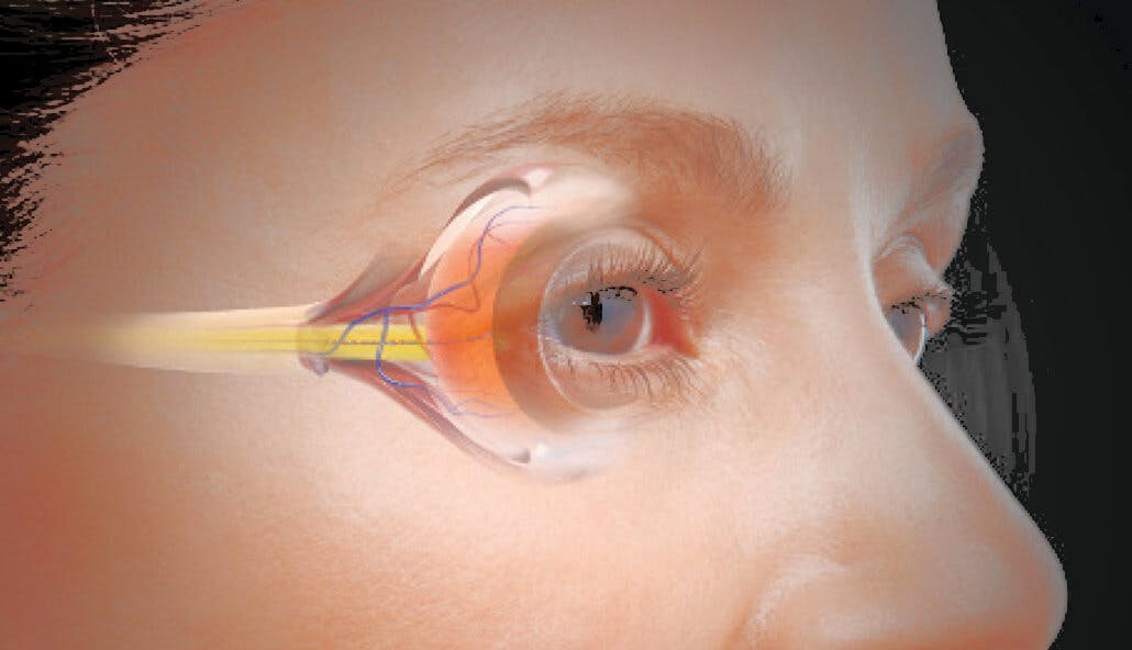 internal image of the eye