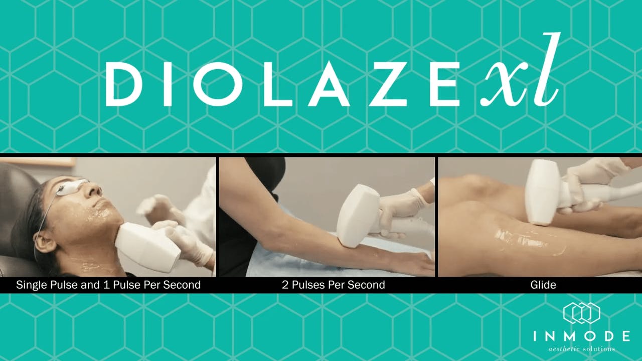 DiolazeXL video