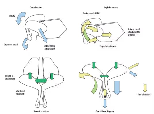 The Tripod Theory of Nasal Tip Support Revisited: The Cantilevered Spring Model (2008)