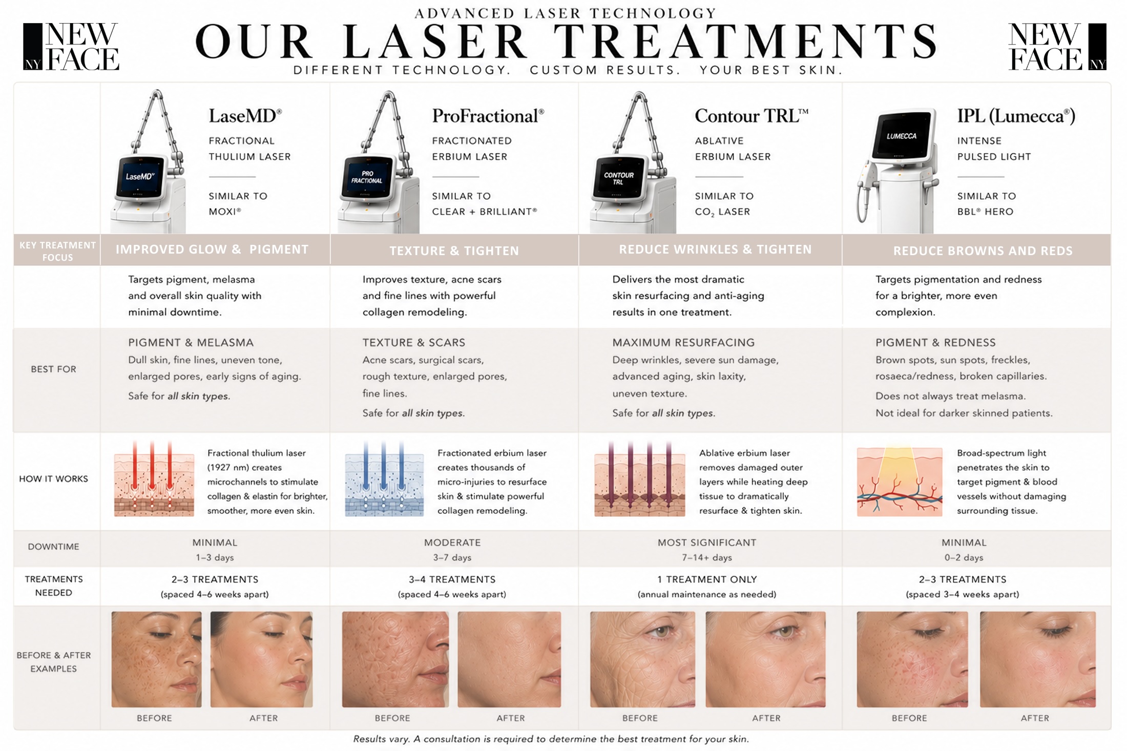 Comparison chart of laser skin treatments at New Face NY