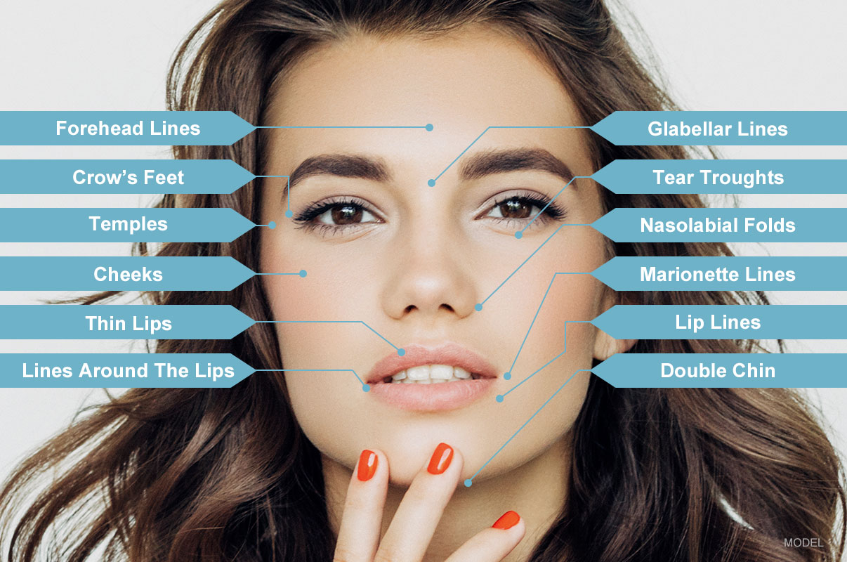 Dermal fillers diagram