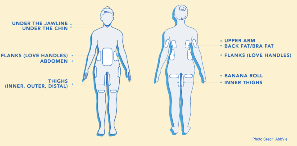 Coolsculpting treatment areas image