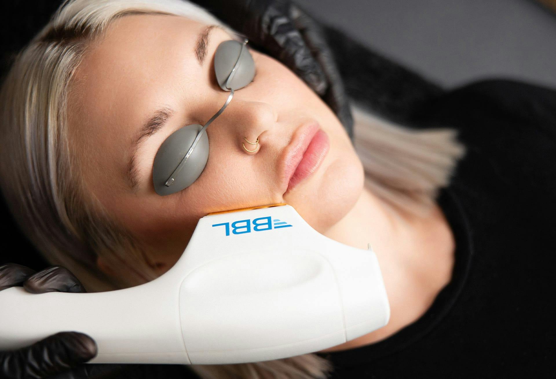 woman receiving laser treatment