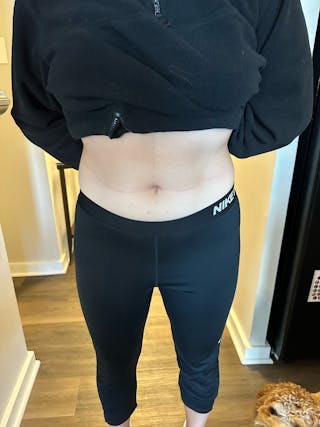Woman showing stomach
