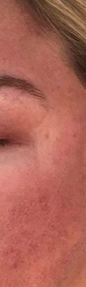 Before and After
