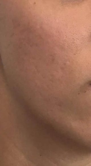 After - Woman