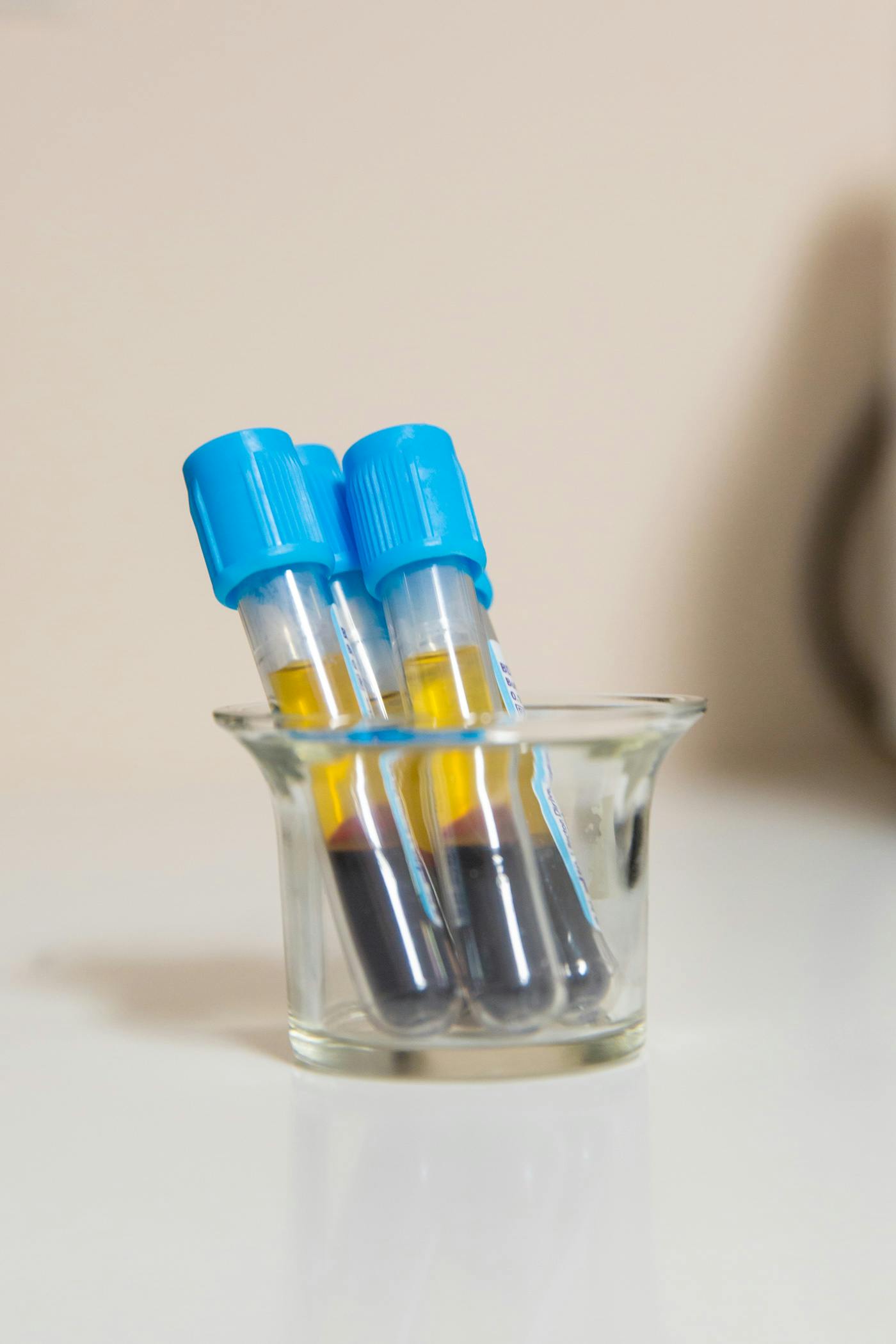 blood in vials