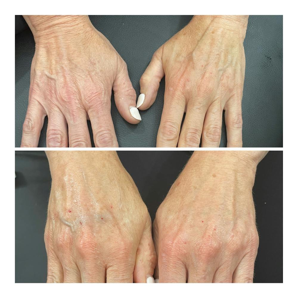 patient results