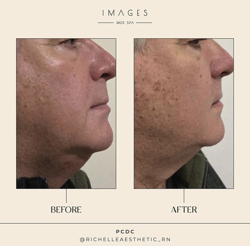 patient results