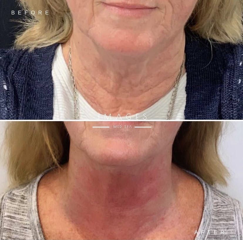 patient results