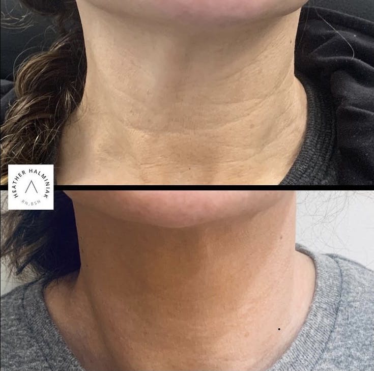 patient results