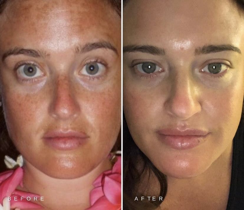 patient results