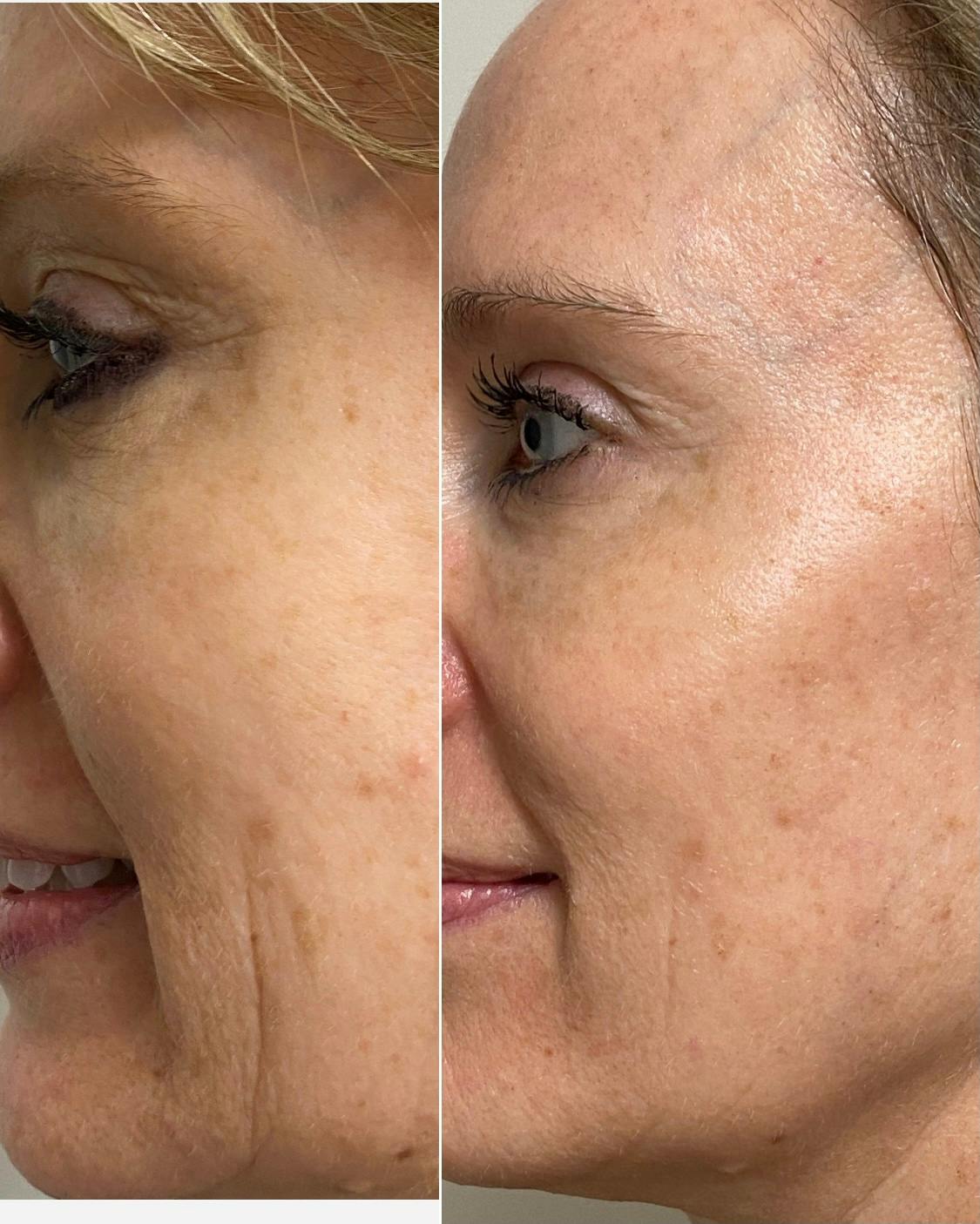 patient results