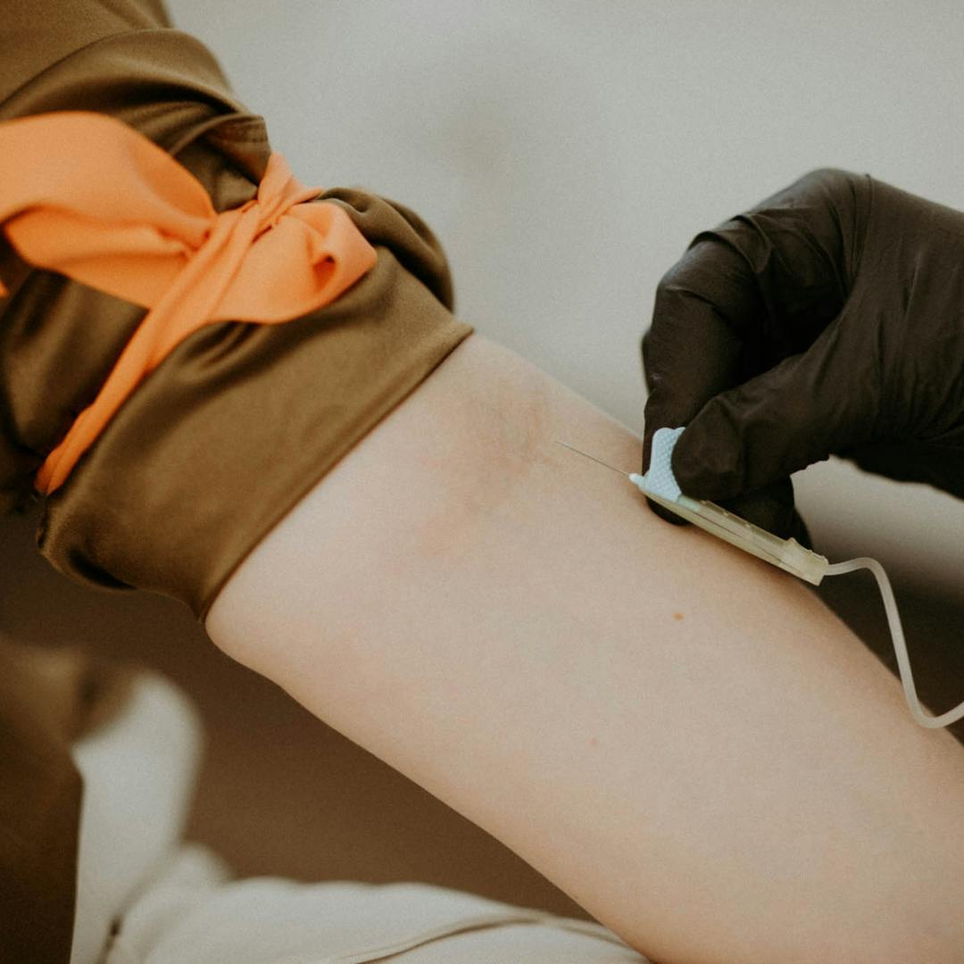person getting an iv treatment