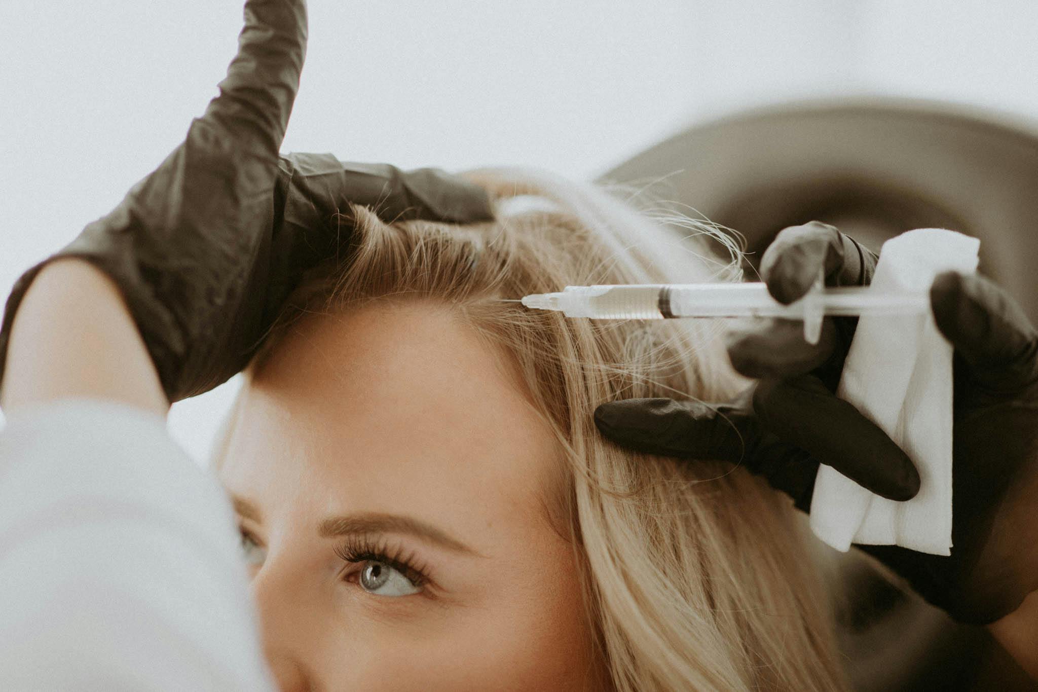 woman getting prp treatment