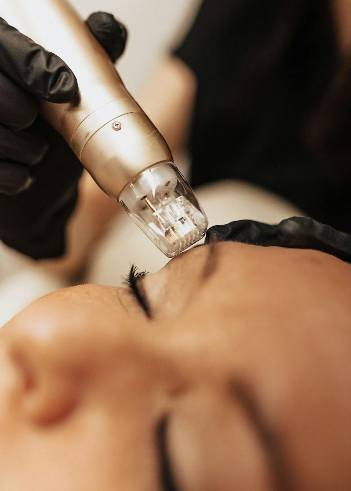 patient getting a nonsurgical face procedure