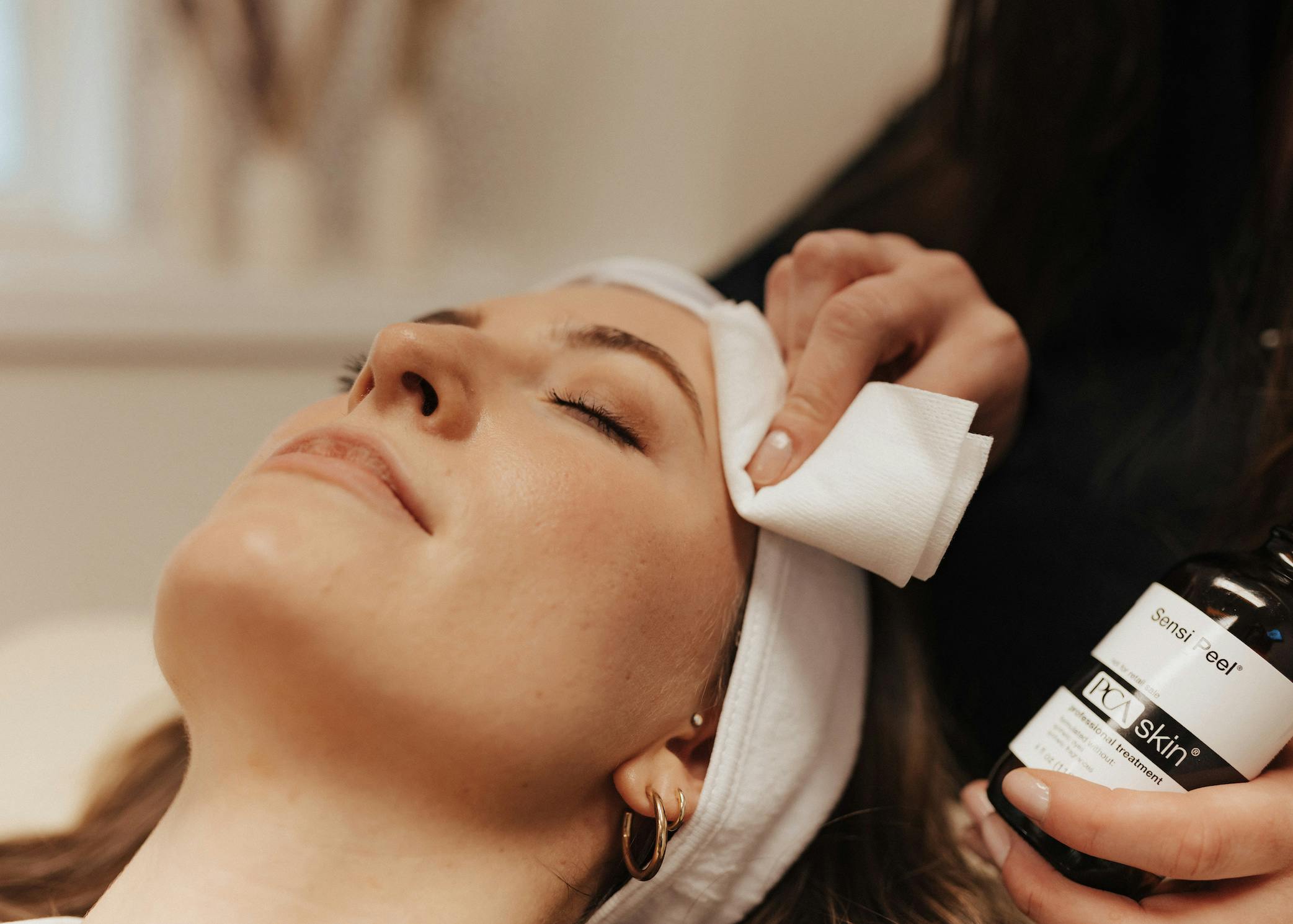 What are chemical peels, chemical peels, chemical peels for acne, chemical peels for acne scars, do chemical peels hurt