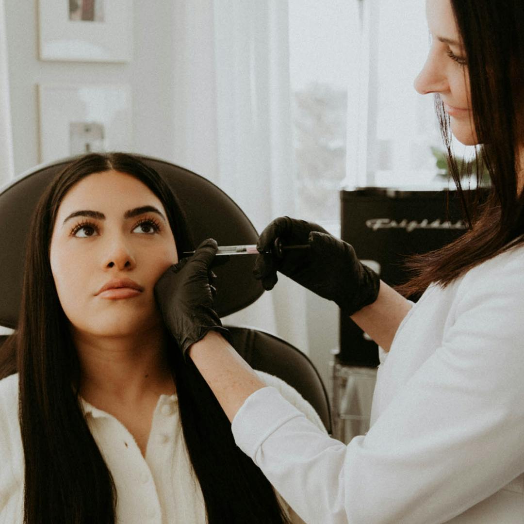 woman getting sculptra treatment