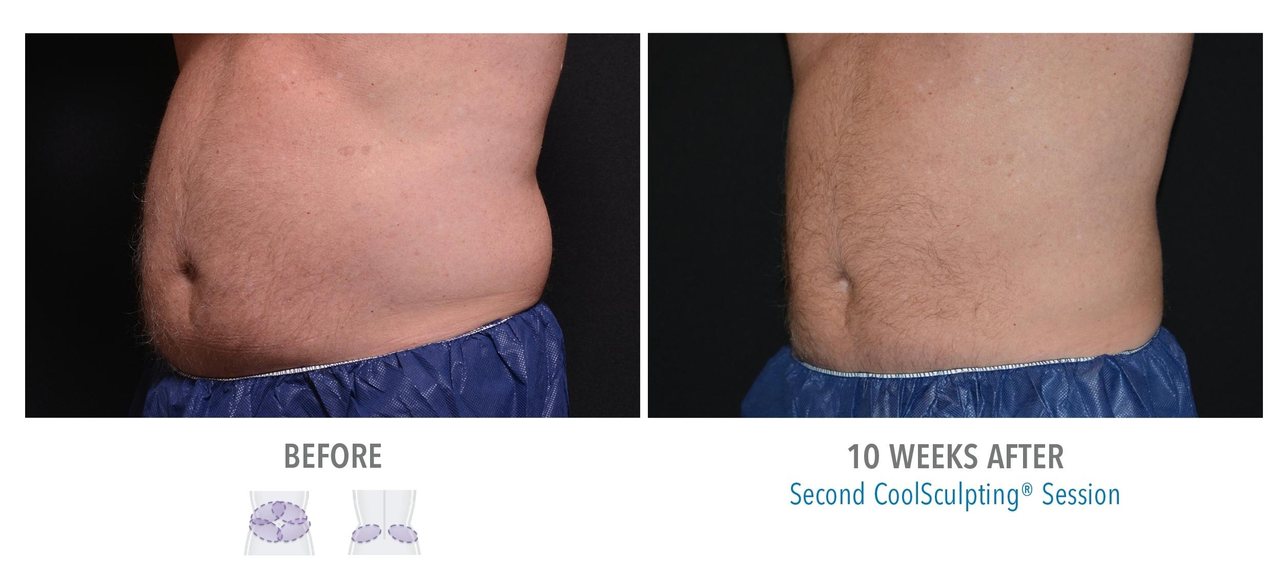 patient results