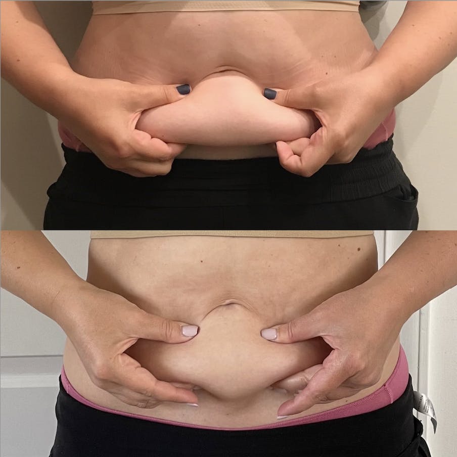 patient results