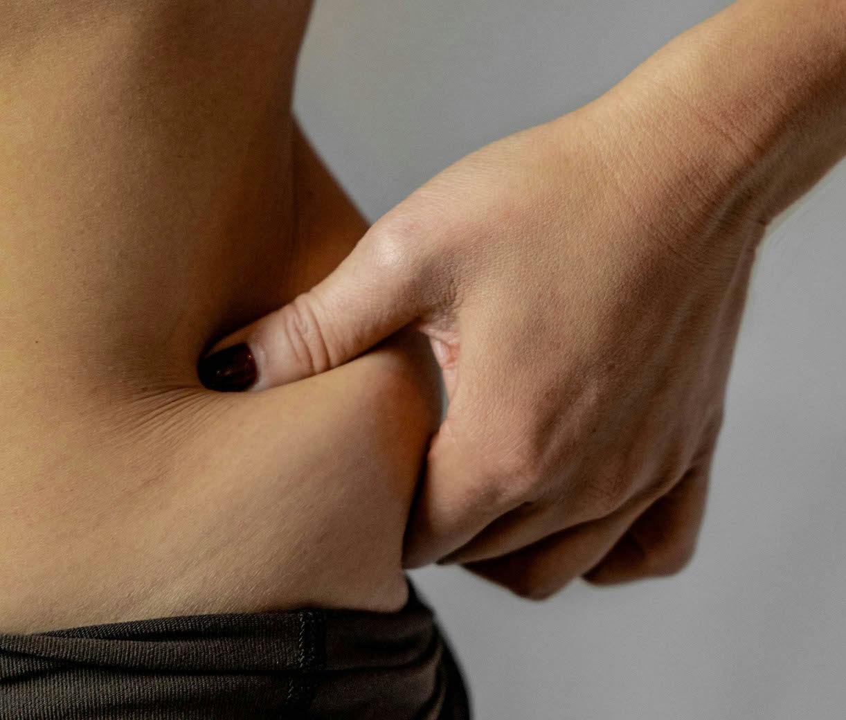 someone pinching their loose skin