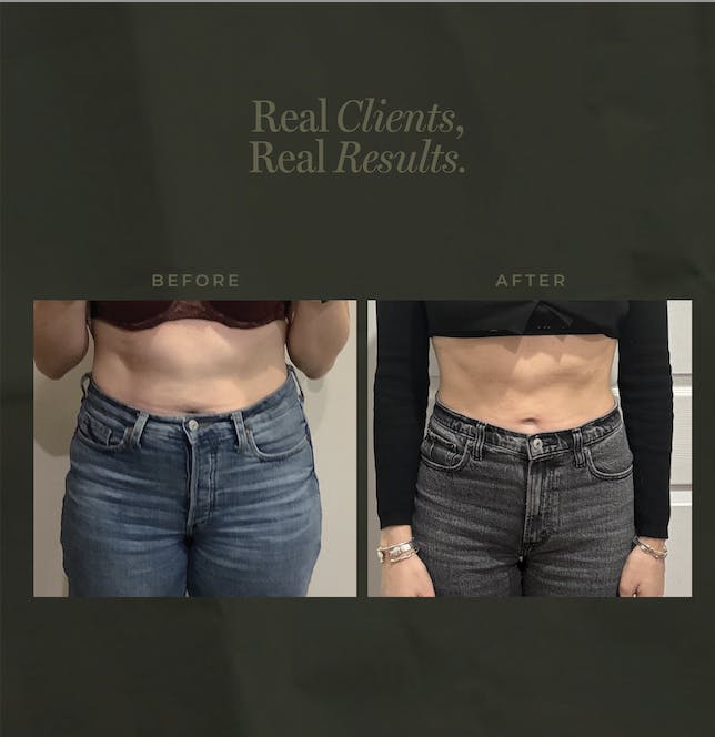 weight loss results