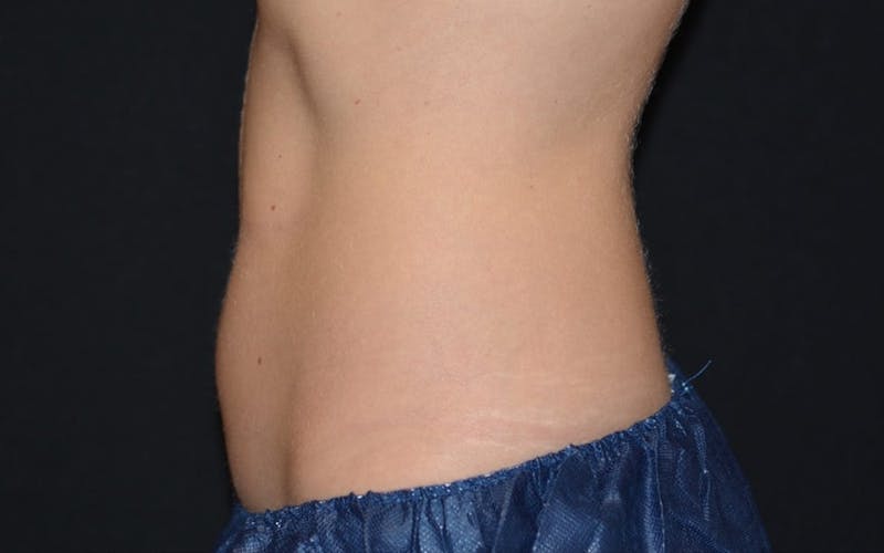 Lower Abs of Female