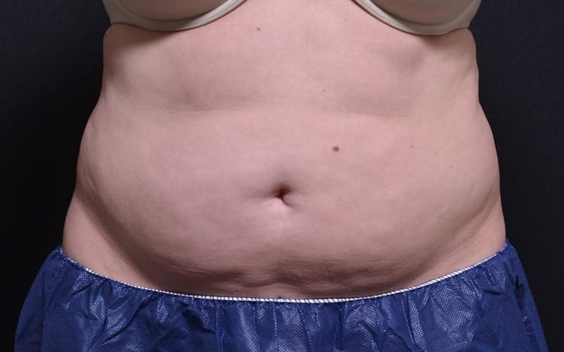 Lower Abs Female