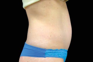Woman's Belly