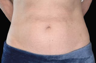 Woman's Belly