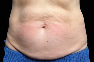Belly