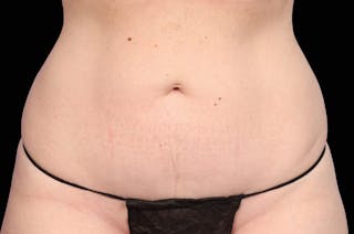 Belly