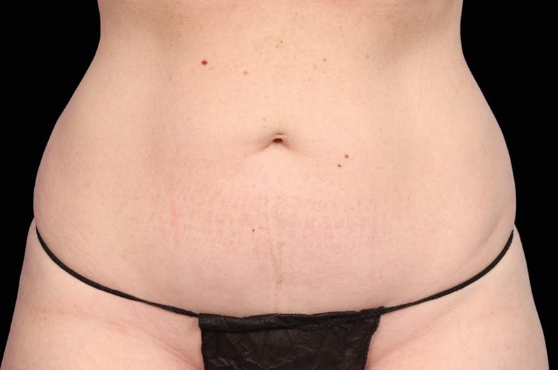 Belly