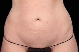 Woman's Belly