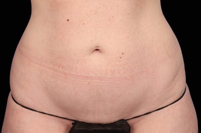 Woman's Belly