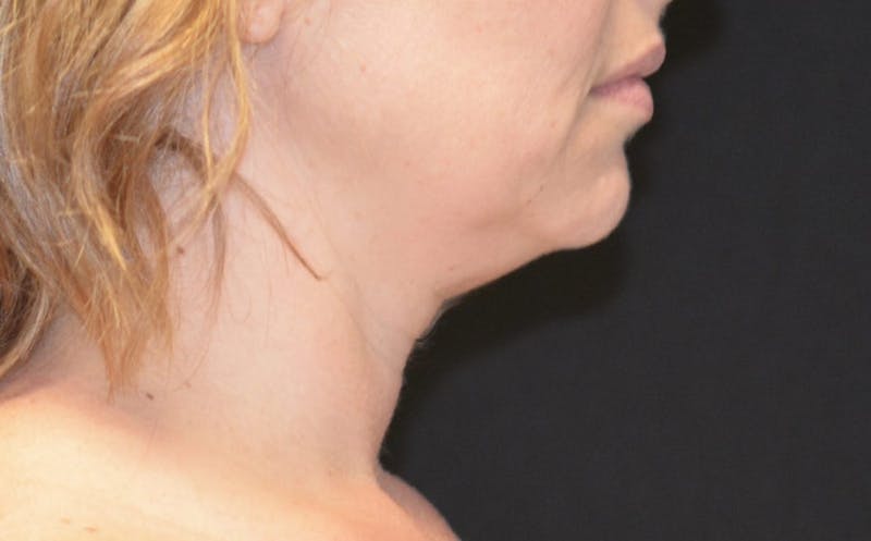 there is a woman side profile