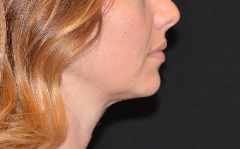 a close up of a woman with a red hair and a black background
