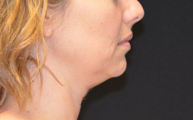 there is a woman with a very long neck and a very short face