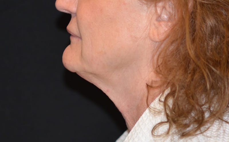 there is a woman with a red hair and a white shirt