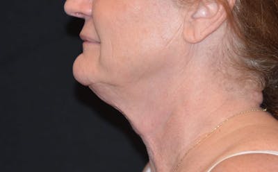 a close up of a woman with a necklace