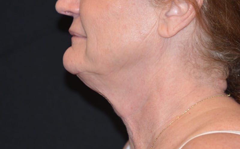 a close up of a woman with a necklace