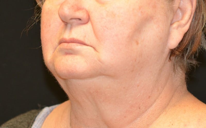there is a woman with a very large neck and a very short neck
