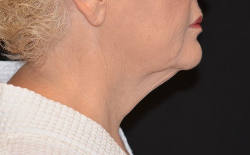 there is a woman side profile