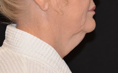 there is a woman side profile