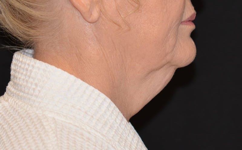there is a woman side profile